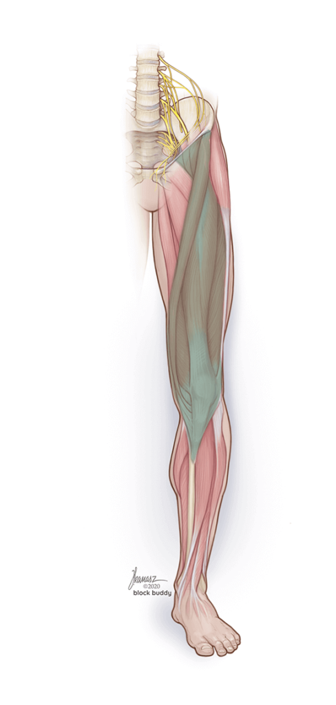 Fascia Iliaca Block Perform Nerve Blocks With Block Buddy