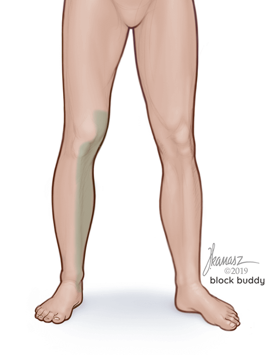 Adductor Canal Block Shaded Area Illustration