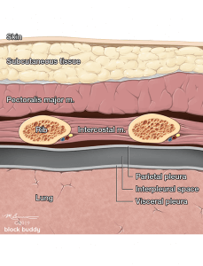 COVID-19 Lung Ultrasound Pneumothorax Illustration