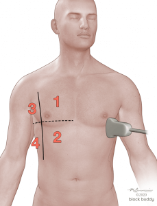 COVID-19 Lung Ultrasound Lung Area Numbered Illustration