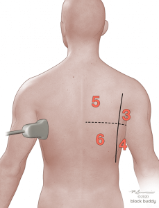COVID-19 Lung Ultrasound Lung Area Numbered Illustration Back View