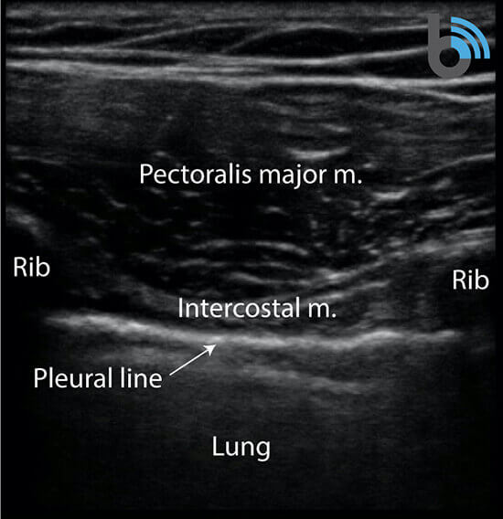 COVID-19 Lung Ultrasound Scan