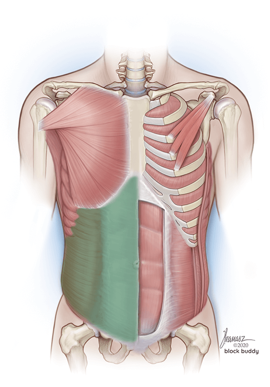 Quadratus Lumborum Block (QL3) Shaded Area Muscular Illustration