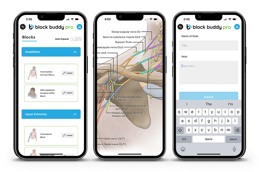 Sample Screens of the Block Buddy App for Ultrasound Guided Nerve Blocks